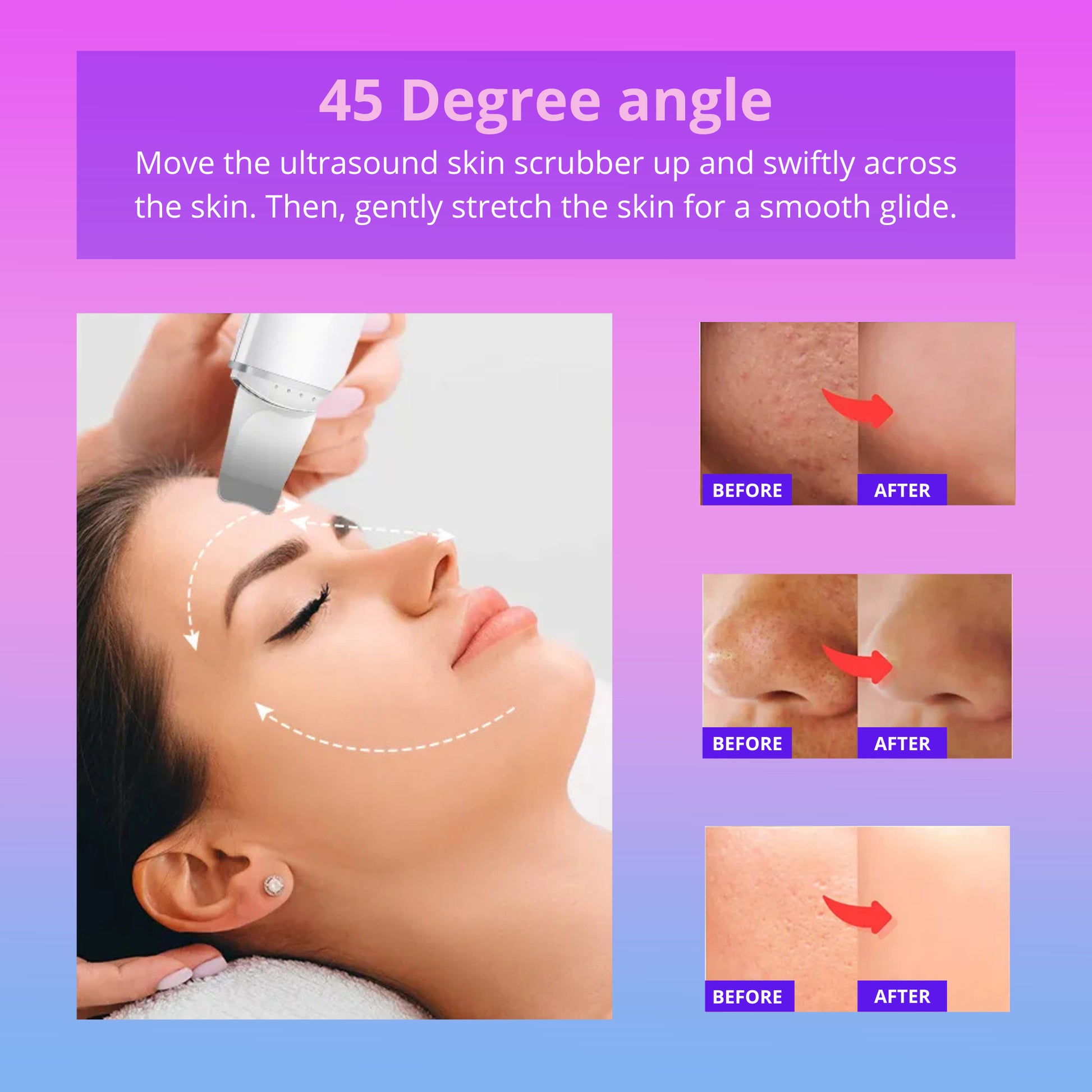 Skinessence PRO™ - Facial skincare Enhancer - by Blossomskin - BeHappy Store -