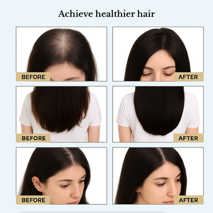 Red & Blue Light Electric Scalp Massager Brush – Hair Growth & Relaxation Comb for Women